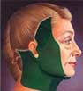 Lifting facial