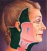 Lifting facial