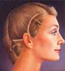 Lifting facial