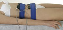 Casos de aplicaci&oacute;n en tratamiento para flaccidez