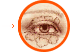 Cirug&iacute;a de p&aacute;rpados (Blefaroplast&iacute;a)